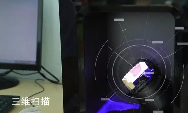 “隱形矯正 試戴牙套”公益活動招募中，名額僅限50名。